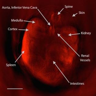 MSOT: optoacoustic imaging at multiple wavelengths.