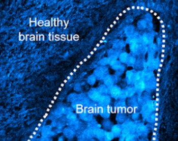 Seeing the margins: accurate tumor identification