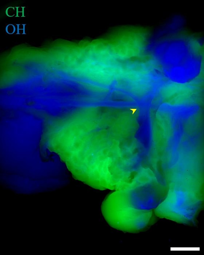 Clearer views: tissue imaging