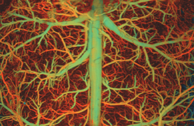 New views of vasculature: details from photoacoustics