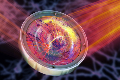 Deformable mirror used in microscopy to focus light within live tissues.