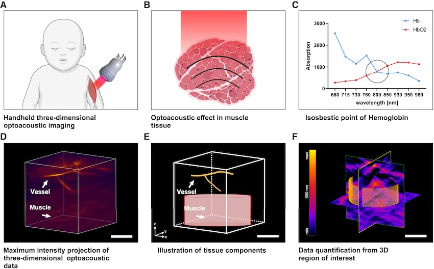 Muscle data: a better picture