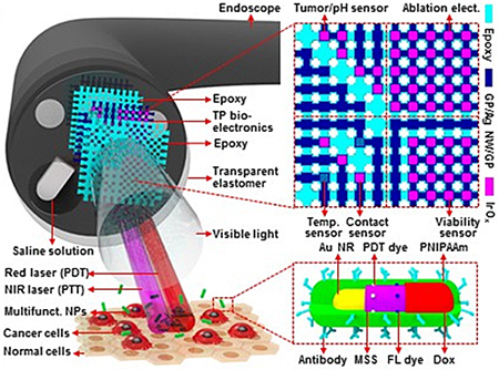 Schematic illustrations of the design mode of use for the multifunctional endoscope.