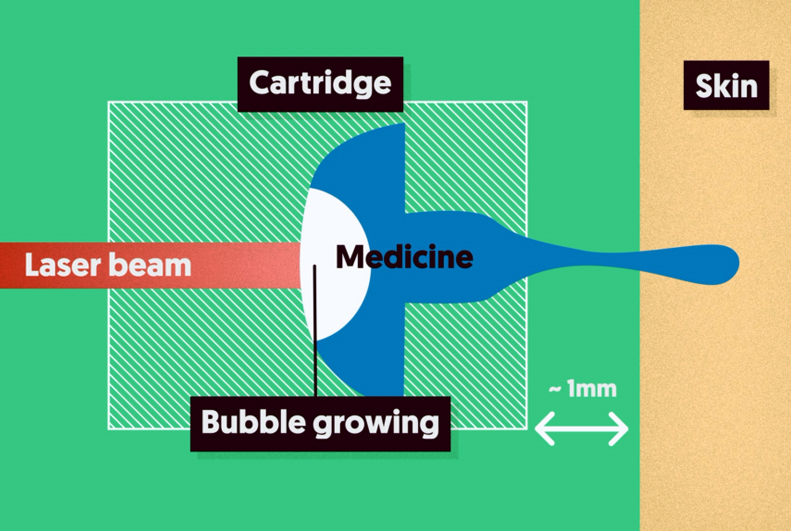 Laser-based: FlowBeam’s novel approach.