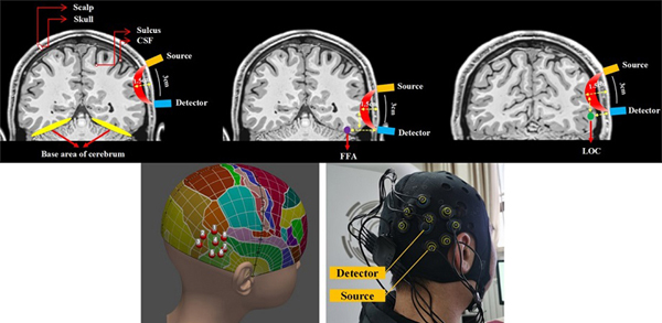 Emitter and detector placed on the scalp near region of interest in the brain.