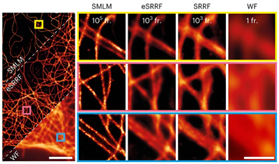 Super-resolved reconstruction images from eSRRF and SRRF. Click for info.