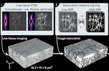 In like a LIONESS: reconstruction of living brain tissue