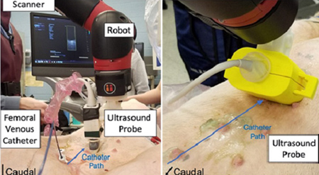 Photoacoustics helps guide cardiac catheters, boosting heart surgery safety. Click for info.