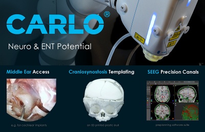 Bone-cutting 'CARLO' laser robot