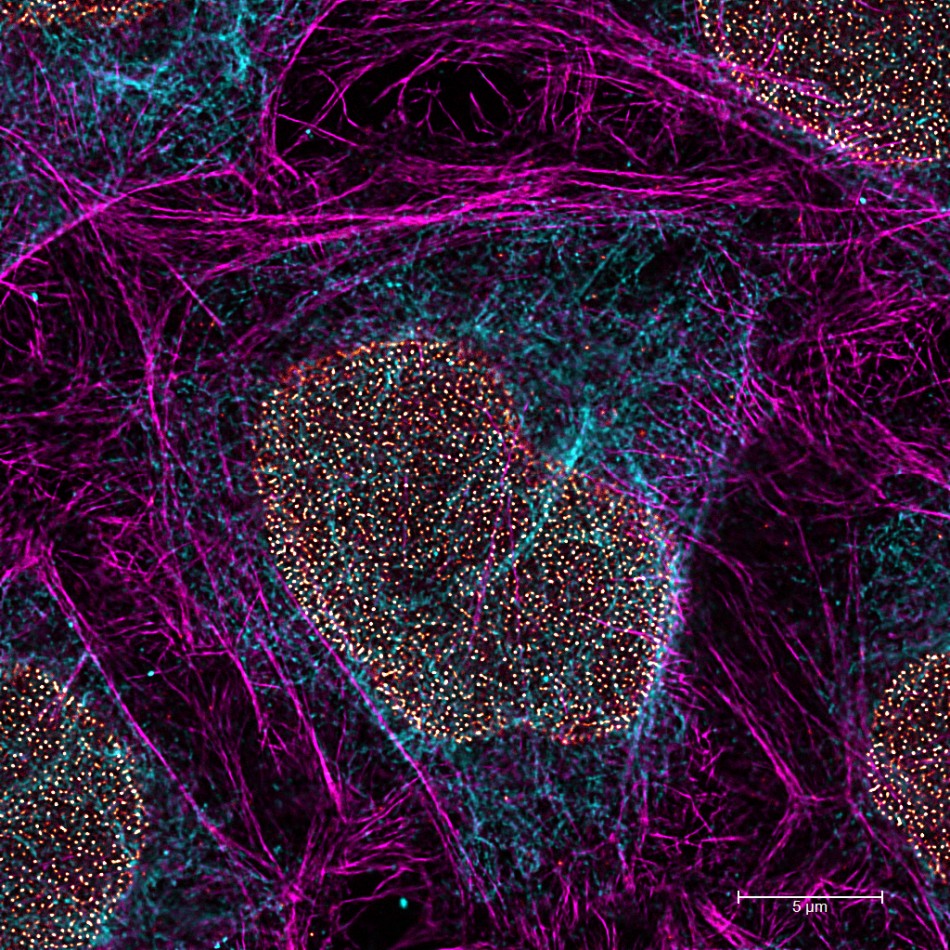 STED for Cell Biology: monitor biological processes