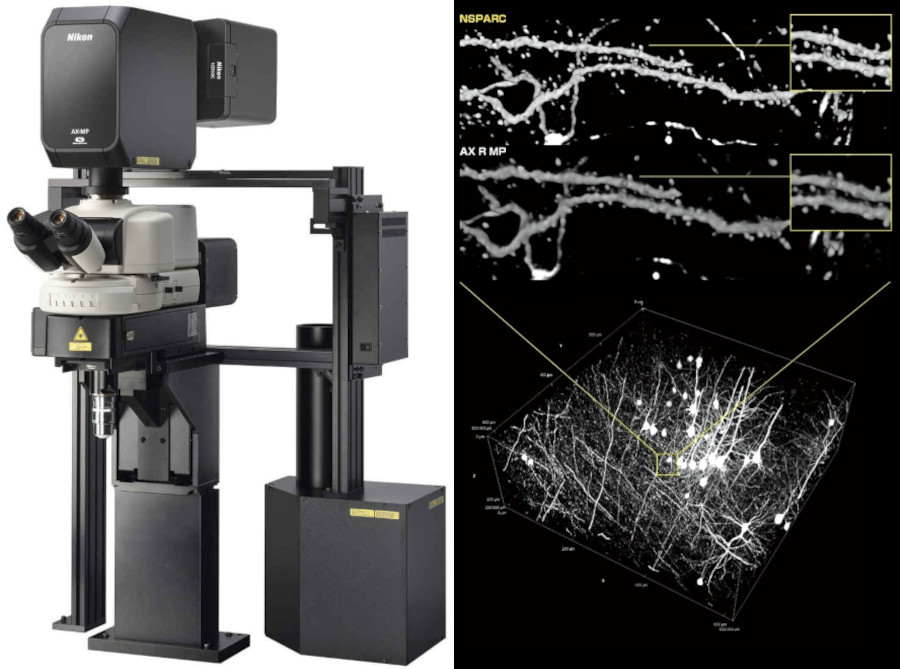 Neural imaging: study of degenerative disease