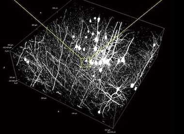 Neural imaging: study of degenerative disease