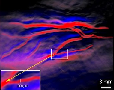 Sounding out blood vessels: arteries and veins 