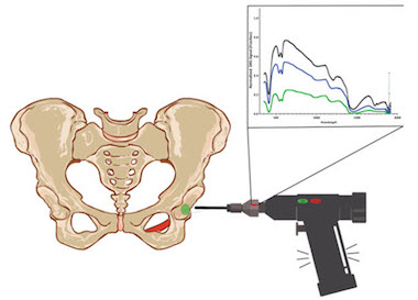 Close to the bone: optical technology