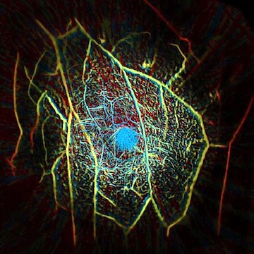 Imaging in 15 seconds: a faster photoacoustic technique