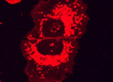 Plasmon at work: molecular jackhammers