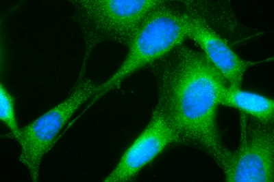 Single-molecule microscopy