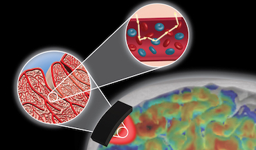 Brain power: optical imaging