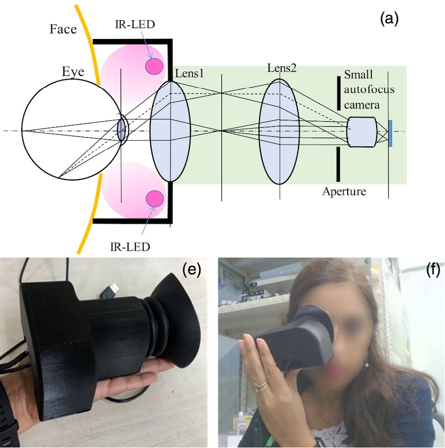 Self-image: retina photography