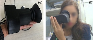 Self-image: retina photography