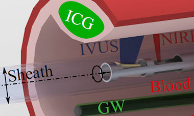 In full flow: imaging in blood vessels