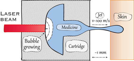 The growing bubble pushes out the fluid, medicine or ink, at 100m/s.