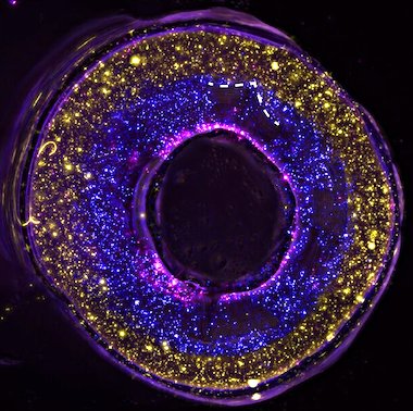 New blood vessel: two bioprinting methods combined