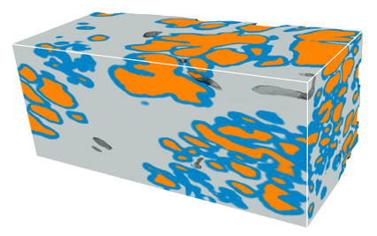 Microscopic glands of the prostate are segmented with the new deep-learning pipeline.