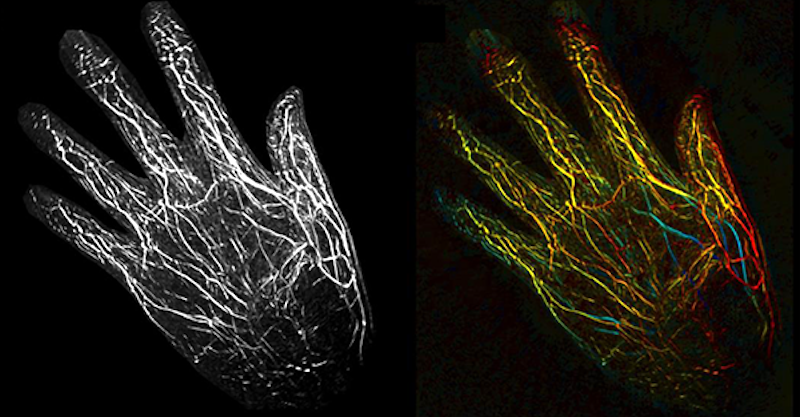 Under the skin: mapping blood supply